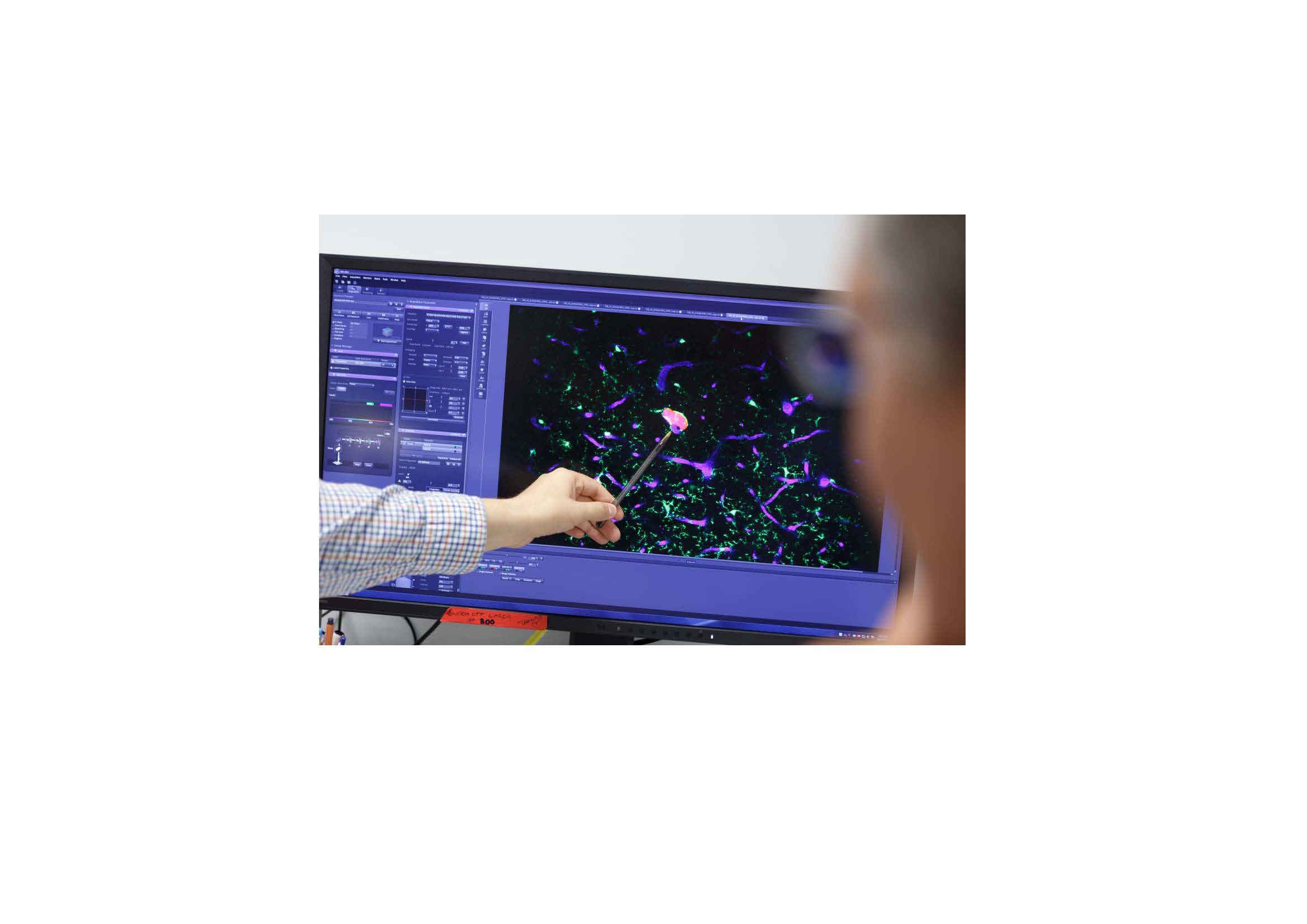 Kernthema des Heidelberger Forschungskollegs für Neuroonkologie ist „Resistenz bei hirneigenen Tumoren“.