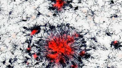 Image: Immune cells