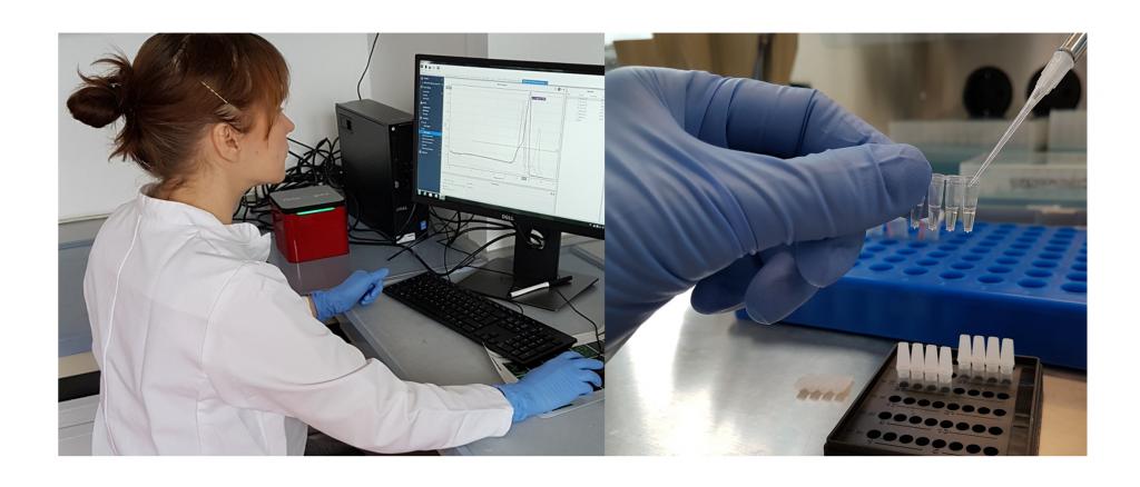 Frau Kosanke beim Vorbereiten der Realtime-PCR-Reaktion für die schnelle und genaue Diagnostik von Hautpilzerkrankungen.