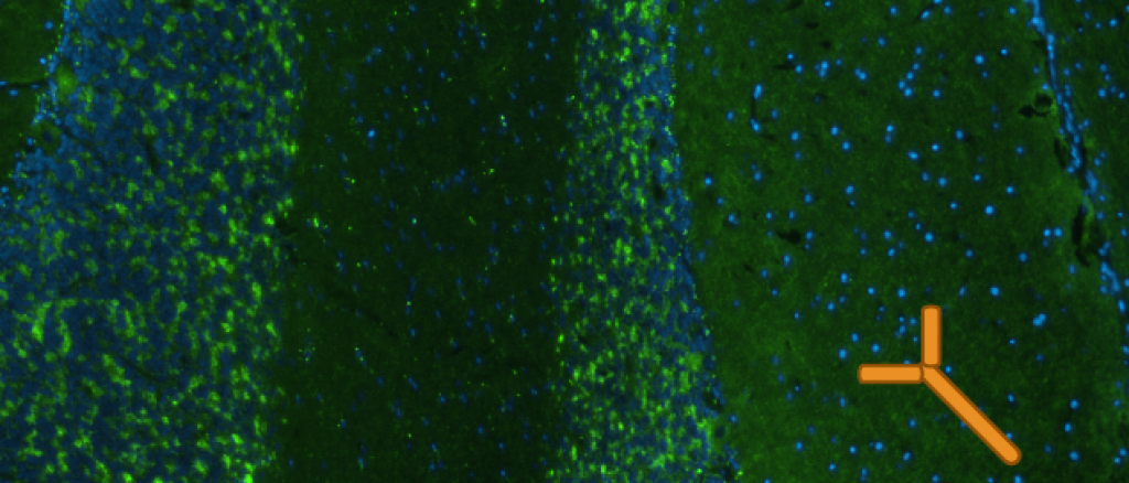 Staining of cerebellar tissue with a monoclonal  GAD-antibody