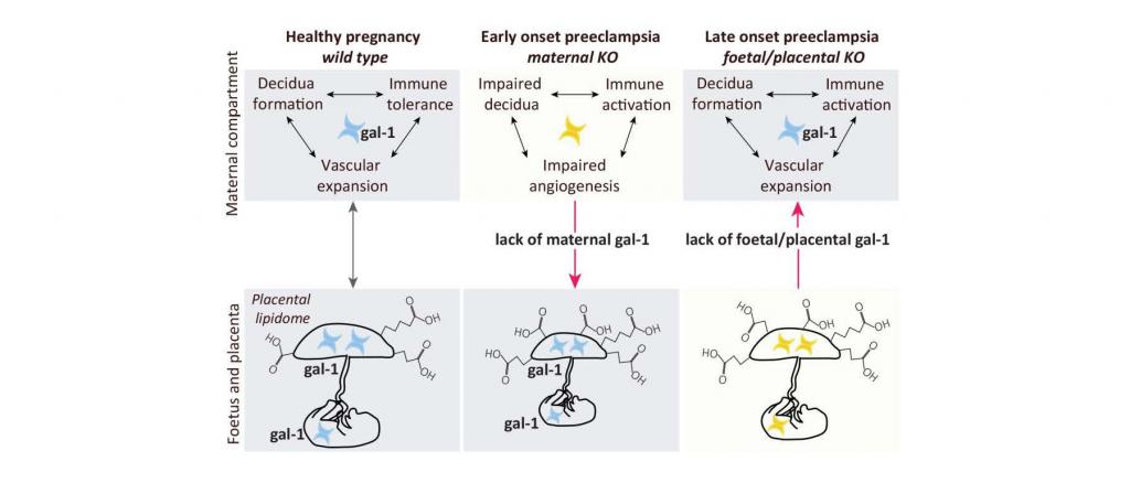 Investigation of galectin-1-sugar-metabolome axis during healthy and preeclamptic pregnancies