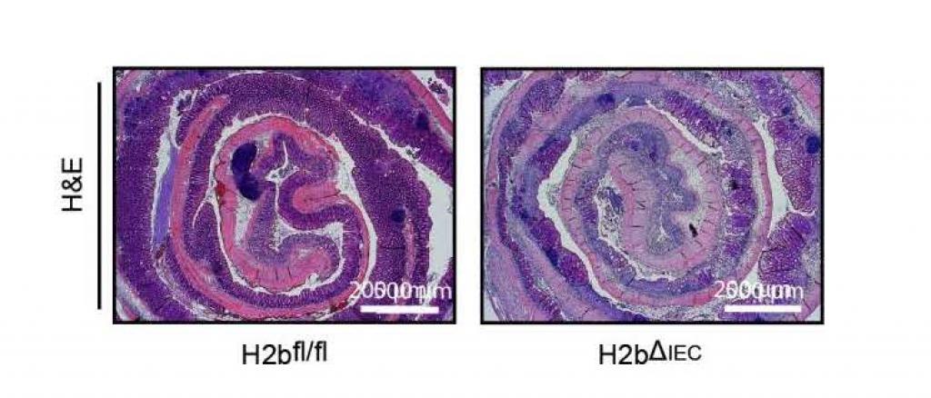 Colitis in mice carrying epithelial specific deletion of RNaseH2b in the intestinal epithelium