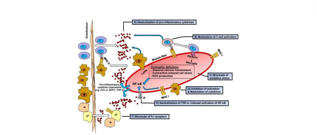 Übersicht über die entzündlichen Mechanismen der Muskeldystrophie Duchenne und die günstigen Effekte von Immunglobulin G auf die Pathologie der Erkrankung